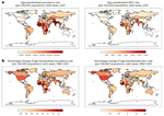 Global, regional and national burden of dietary iron deficiency from 1990 to 2021: a Global Burden of Disease study